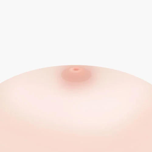 수술 후 결과